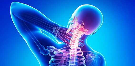 symptoms of neck pain