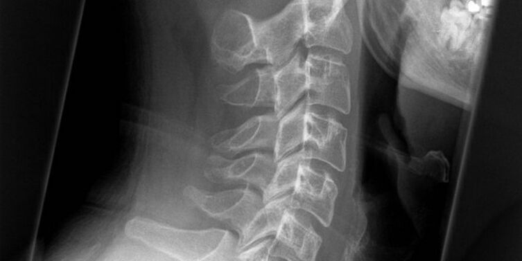 A picture of the cervical region